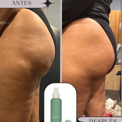 CREMA ANTICELULÍTICA