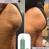 CREMA ANTICELULÍTICA