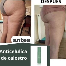 CREMA ANTICELULÍTICA