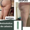 CREMA ANTICELULÍTICA