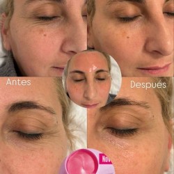 PARCHES CONTORNO DE OJOS COREANOS